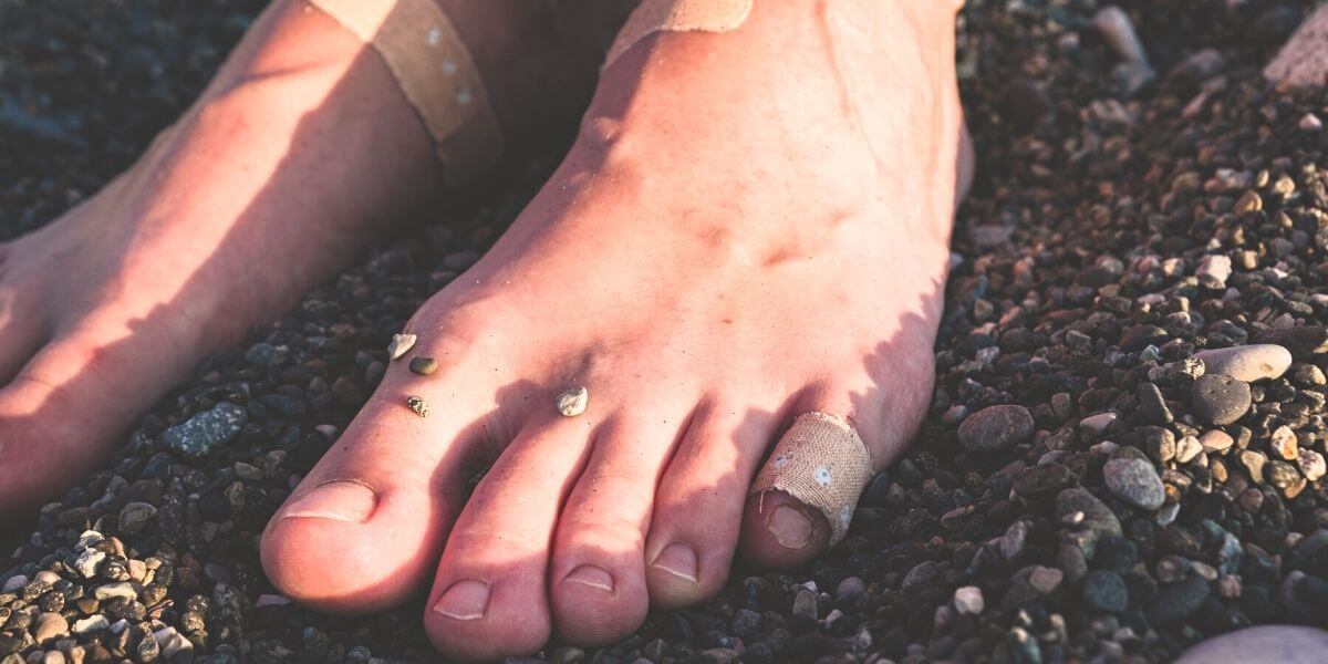 Barfotaskor är inte funktionella