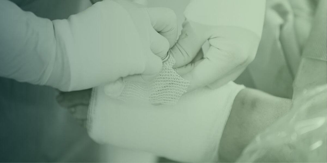 Borde jag operera Hallux Valgus?